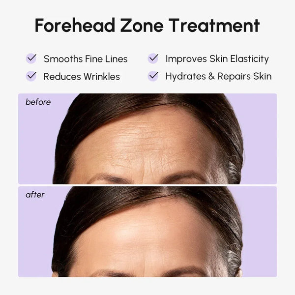 Anti-Wrinkle Forehead Patches - alternate view